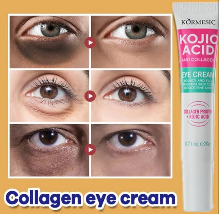 Kojic acid and collagen eye cream