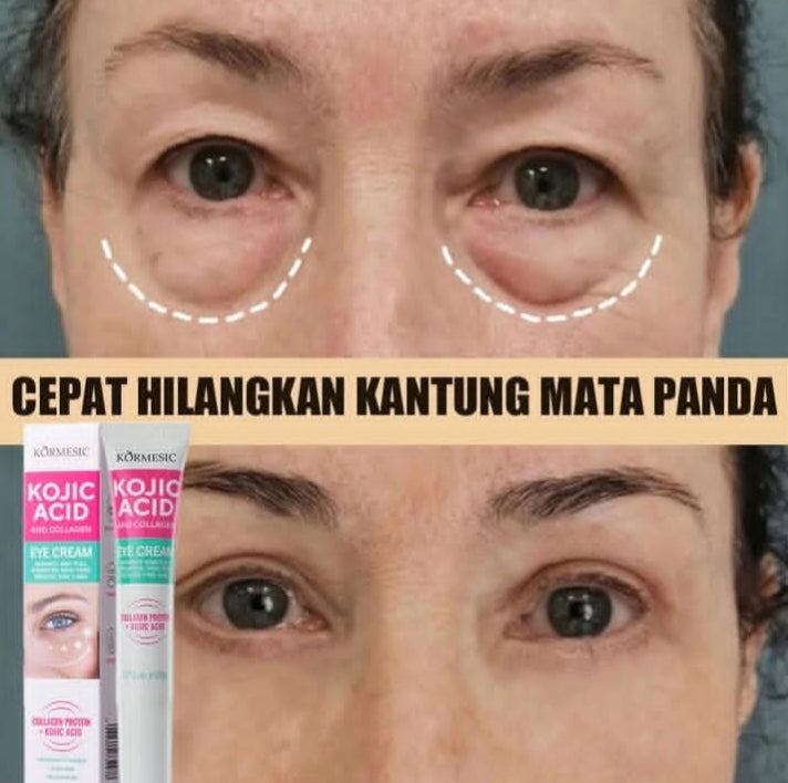 Kojic acid and collagen eye cream